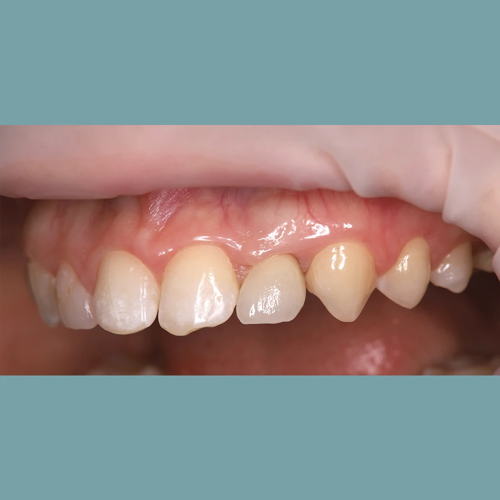 After